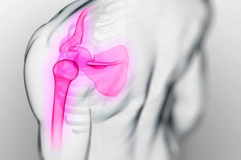 Épaule au TOP a choisi Polynomik pour son site web